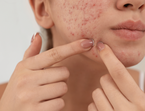 Infected Pimple: Symptoms and Treatments